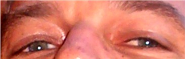 Eyes4